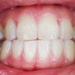 teeth, mouth, dental-887338.jpg